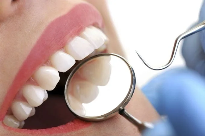 Saiba como tratar a sensibilidade nos dentes 2 dentista